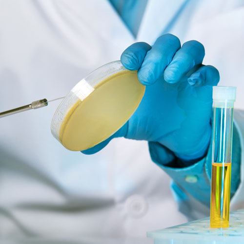 Viren gegen Bakterien: Was st...