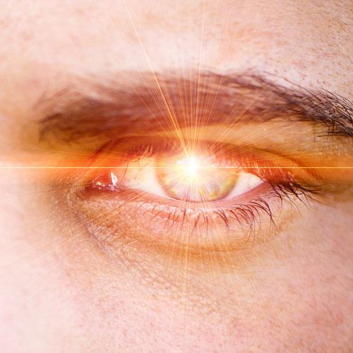 Scharfblick in Sekunden: Kein...