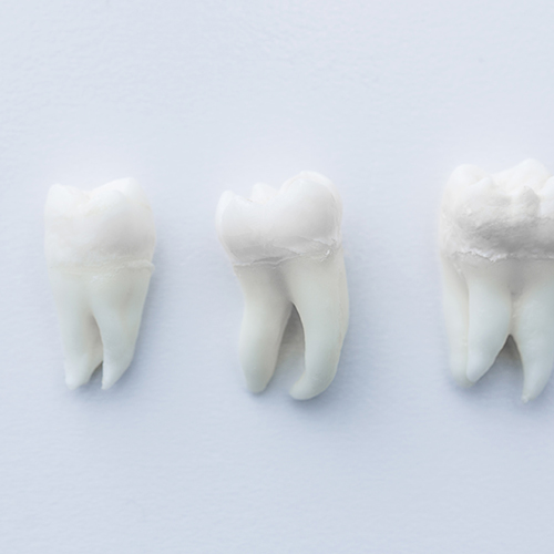 10 Fragen und Antworten zur W...