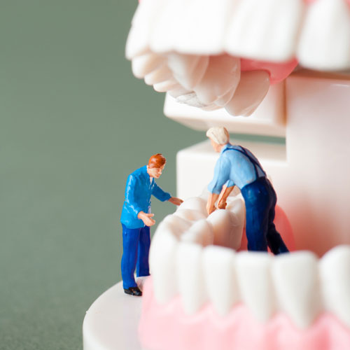 Weisheitszähne entfernen lass...