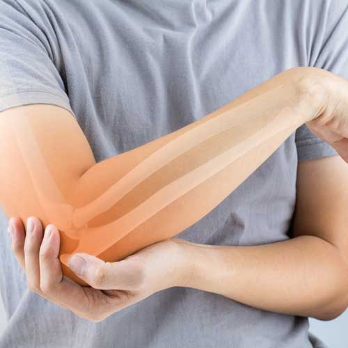 Diagnose Knochenschwund - Wel...